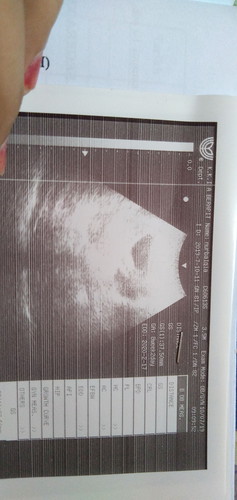 Scan