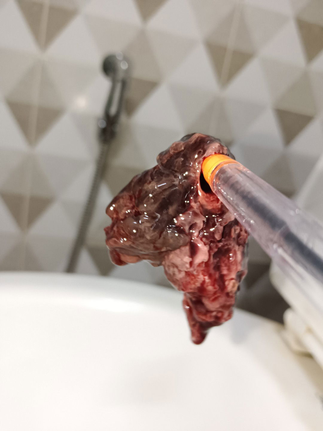 ปวดท้องหลังคลอด 1 เดือน