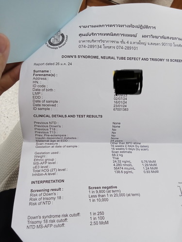 ผลดาว์นซินโดรม