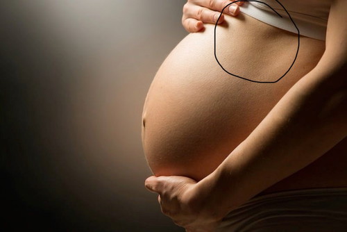 Sakit ats perut 37w2d pregnant
