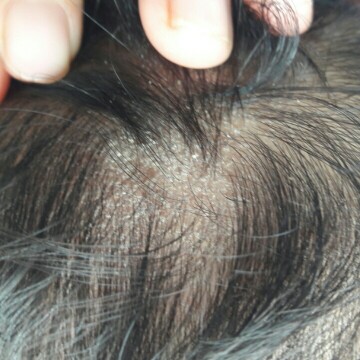 rambut baby