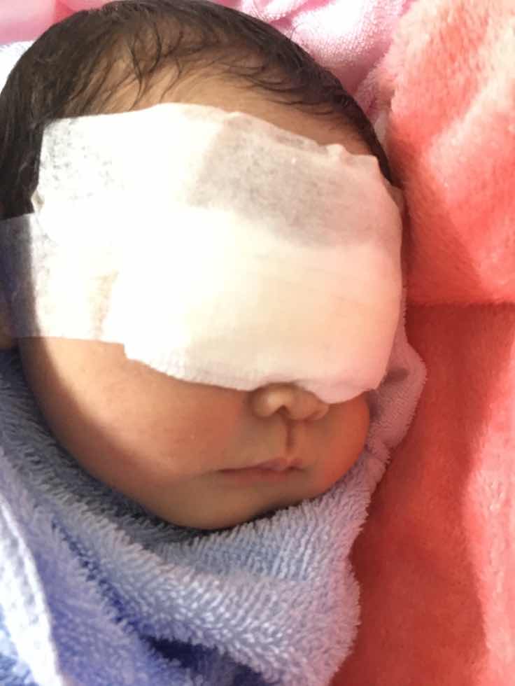 ไข้สูง ตัวเหลือง