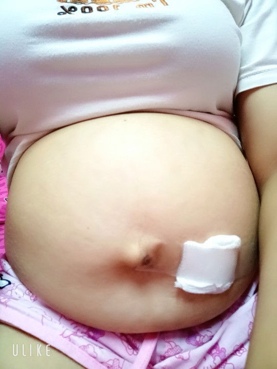 เจาะแล้วคะ