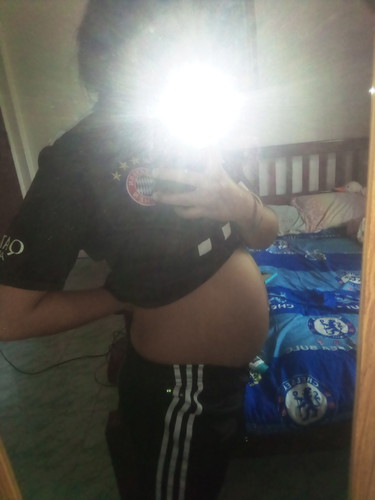 31+1 ท้องทรงเเบบนี้ น้องเพศไหน