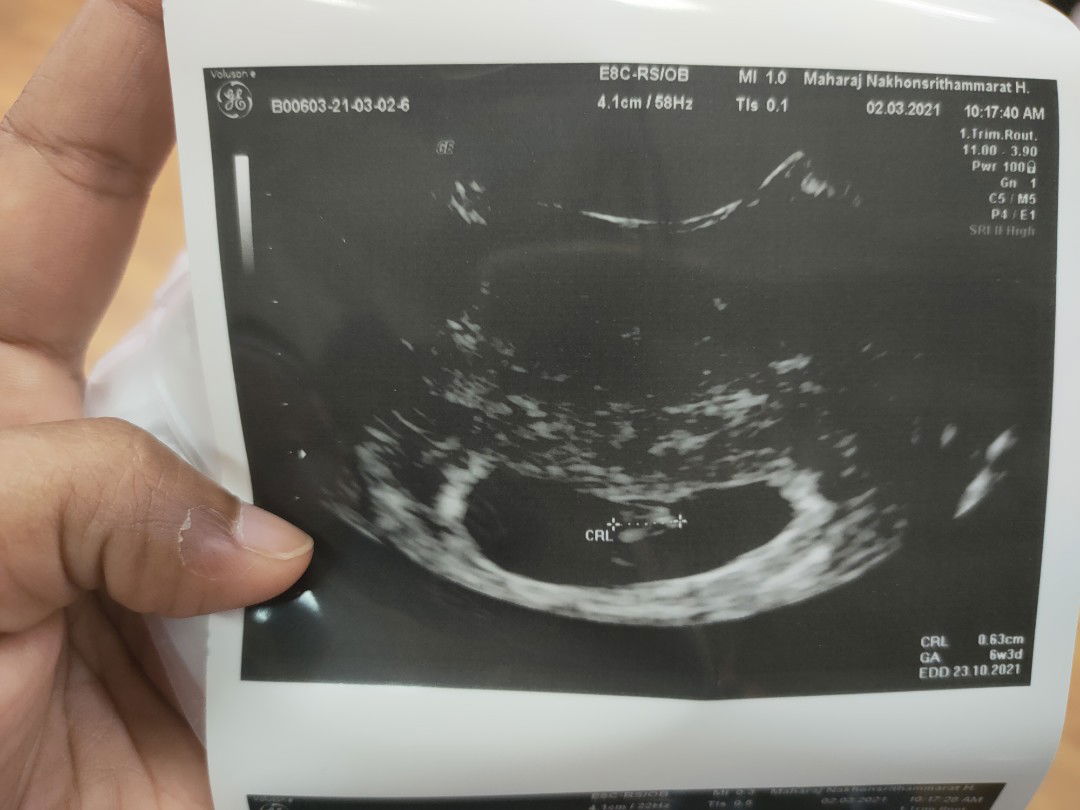 Tariyaporn Boonkong profile icon