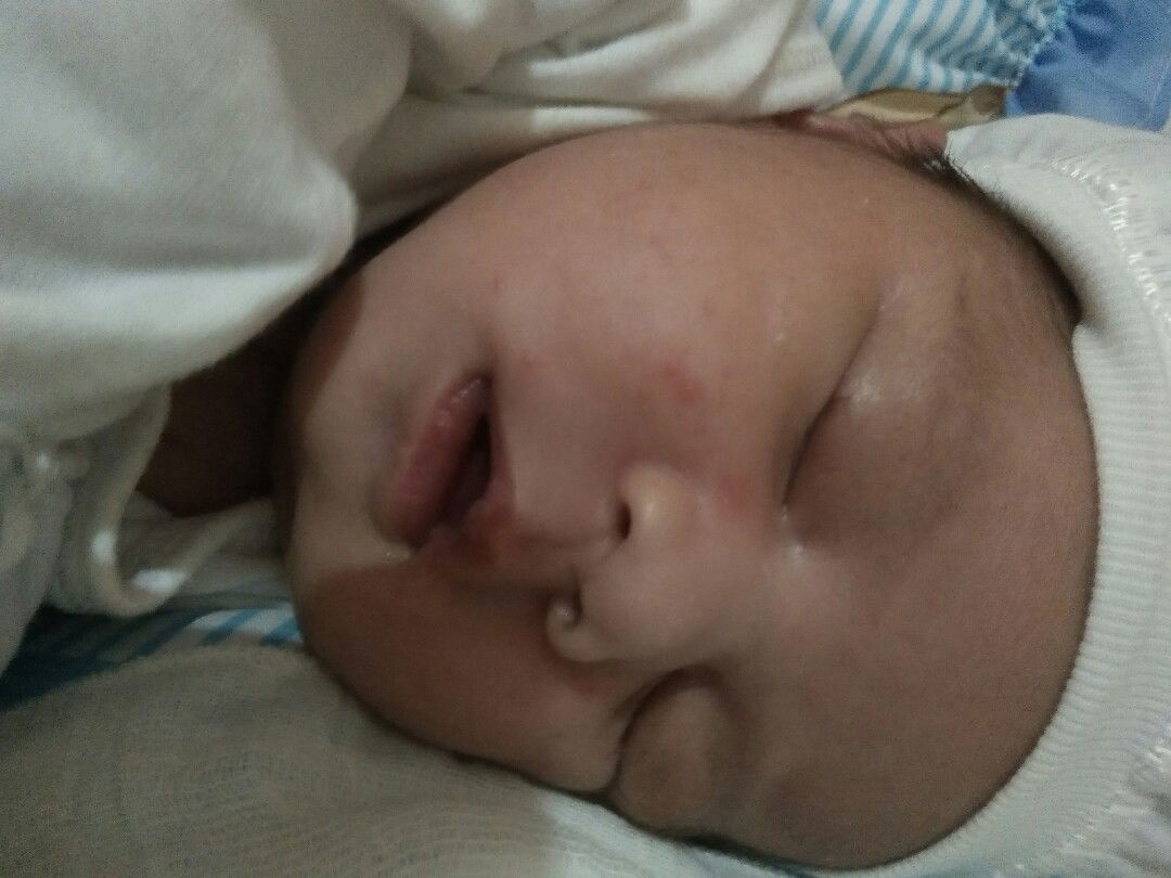 Anu po kaya yan mga momsh sa mukha ng LO q?