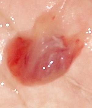 ตั้งครรภ์ 38 สัปดาห์ 4 วัน มูกเลือด