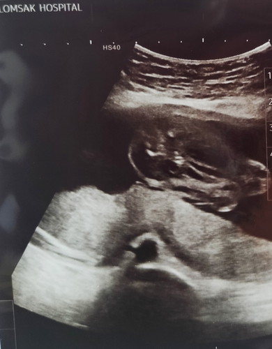 แม่ๆช่วยดูเพศลูกให้หน่อยค่ะ