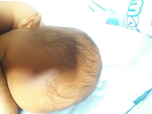 rambut bayi