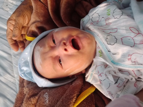 การตัดเล็บลูก