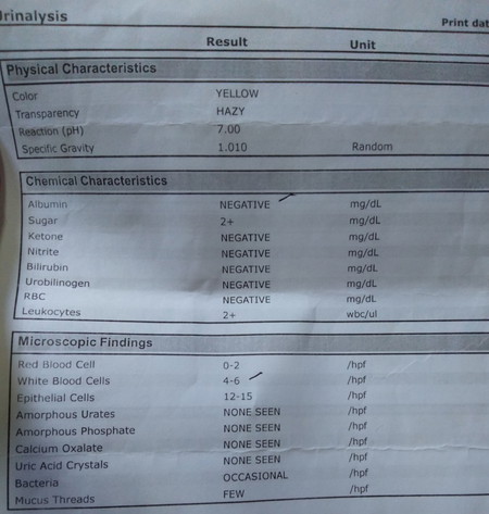 urinalysis result