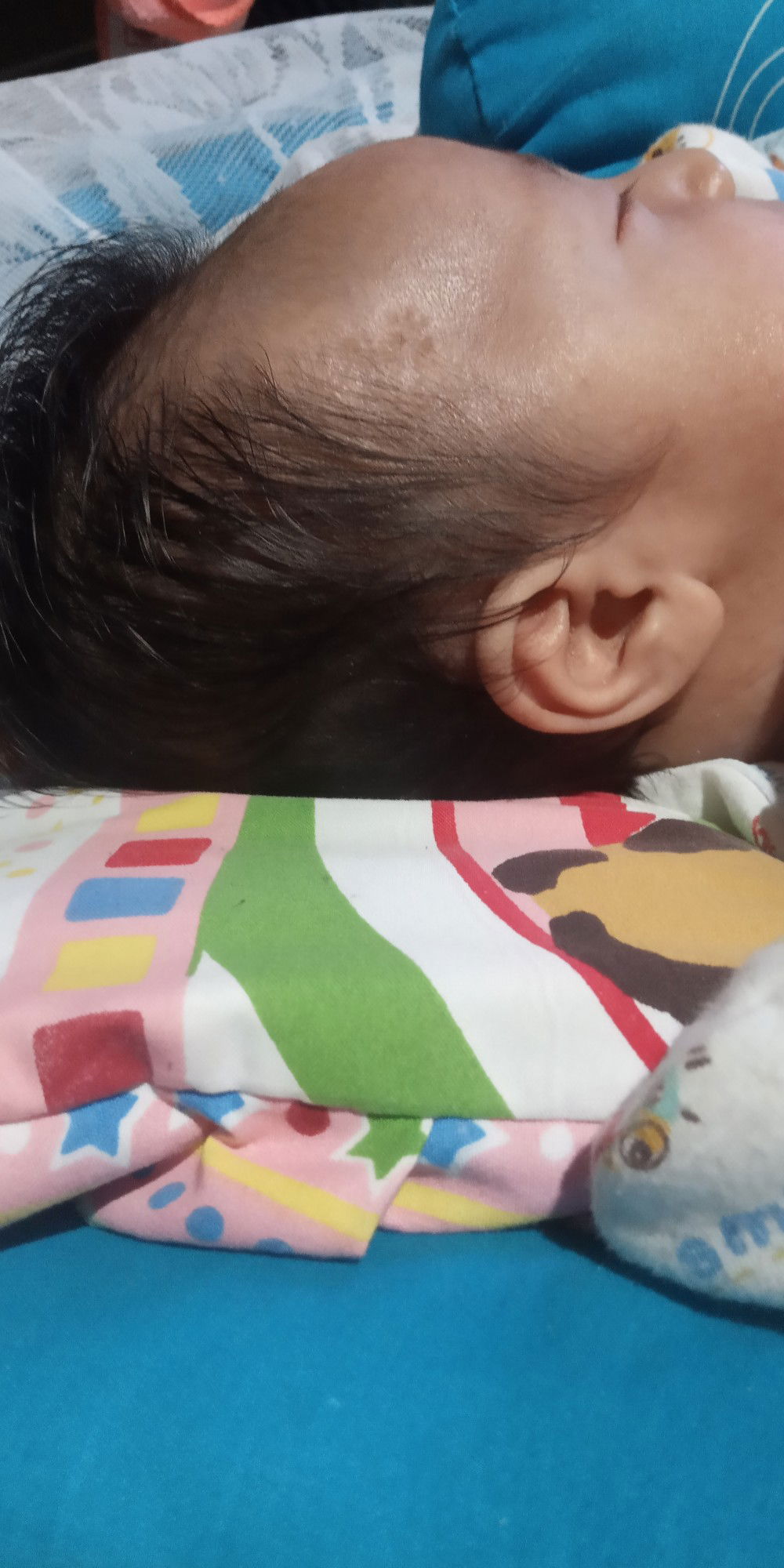 klbentuk kepala bayi