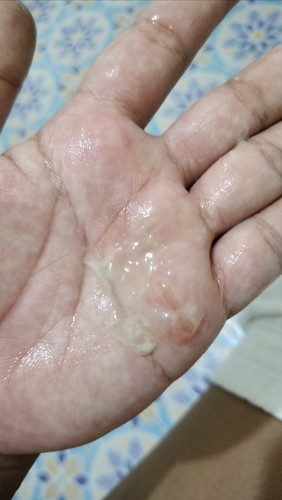 40+5 สอบถามแม่ๆค่ะ อันนี้คือมูกเลือดมั้ยคะ แล้วต้องไปโรงพยาบาลเลยมั้ย