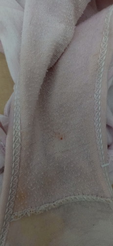 ใกล้คลอด 38w1d