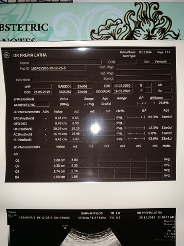 Size kepala baby tak sama dengan weeks.