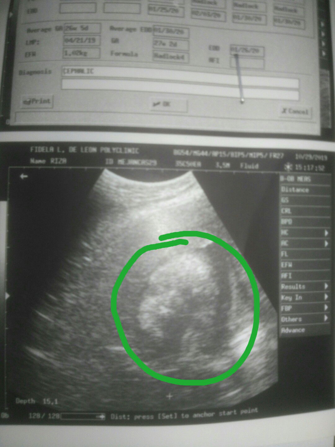 ultrasound