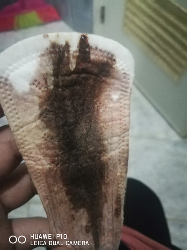 bleeding