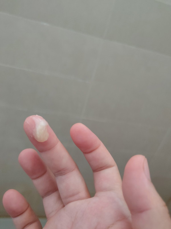 Mucus plug
