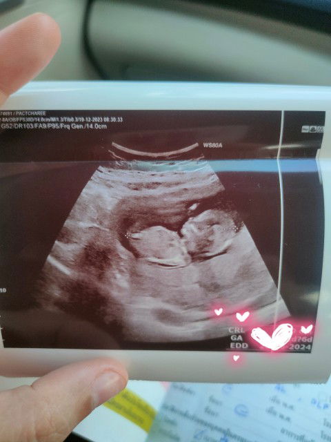 นามิ นามิ profile icon