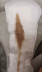 Anyone experienced this?