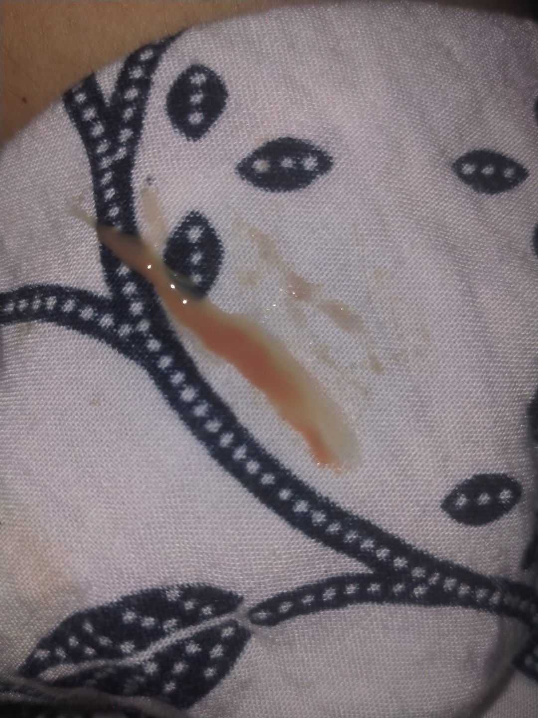 keluar lendir keputihan tapi warnanya ada kecoklatan.