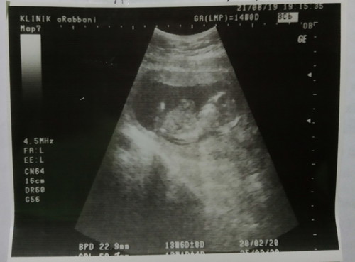 14 week
