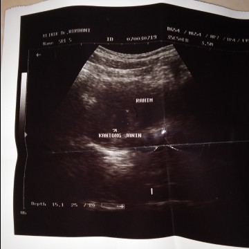 6week/6minggu