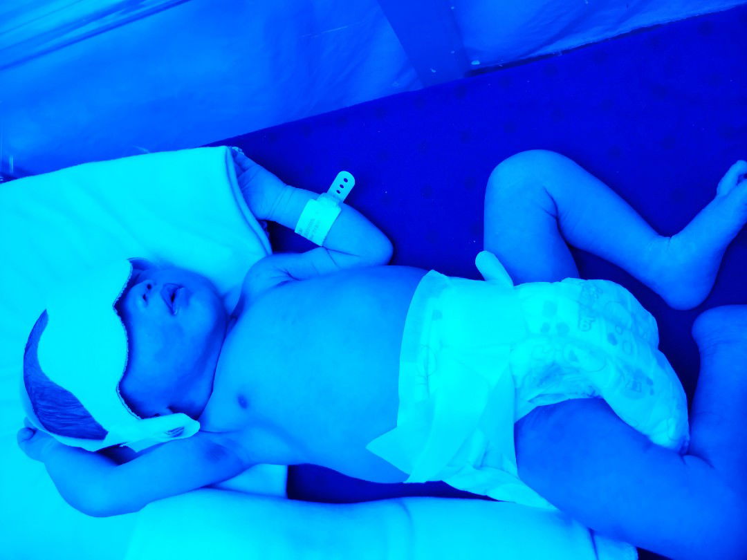 baby belum bisa pulang ??