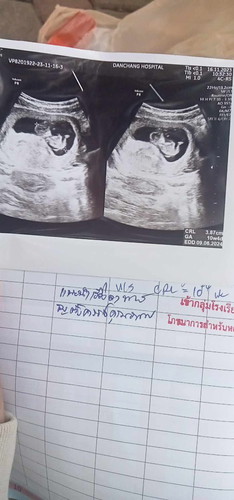 อยากทราบเพศ