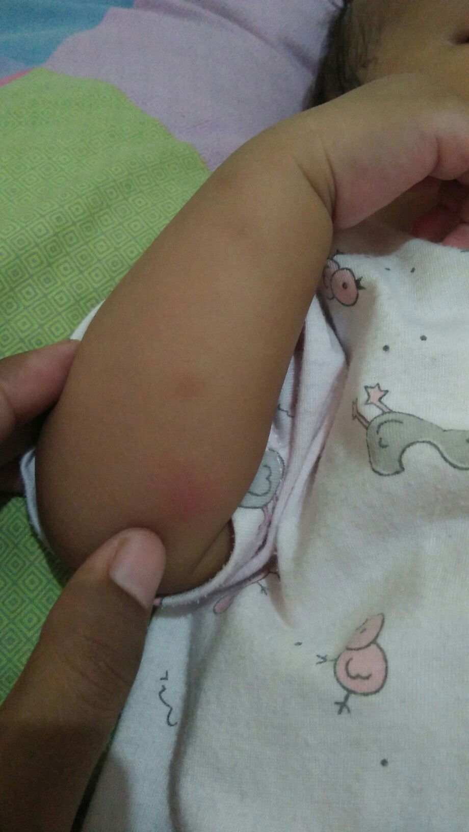 Bekas gigitaan nyamuk