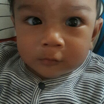 ทีกลางคิ้วน้องขึ้นจุดขาวๆมันคืออะไร