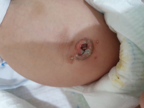 ถามเรื่องจี้สะดอทารกค่ะ