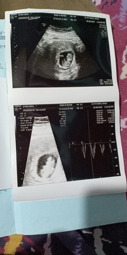 konsumsi penguat usia 11w3d