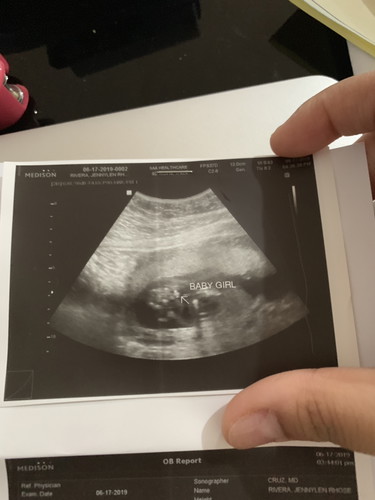 17weeks ultrasound