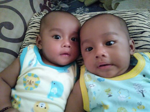 Pertumbuhan rambut bayi