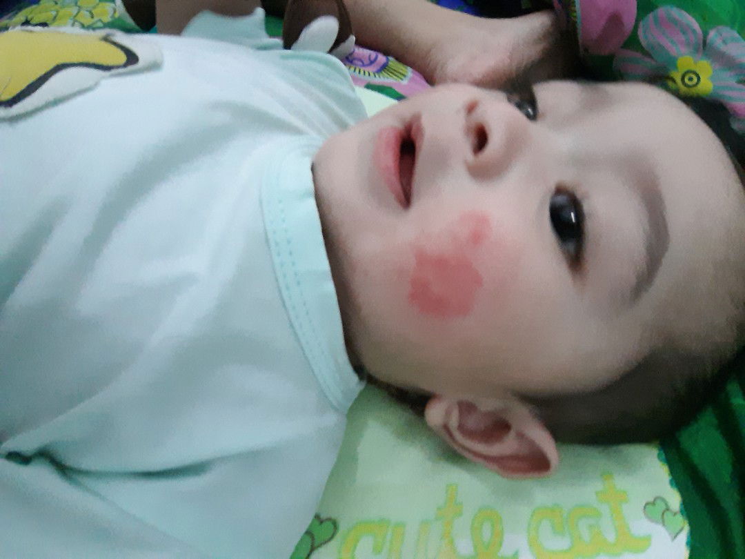 pipi baby merah dan kasar