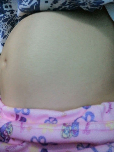 17 weeks
