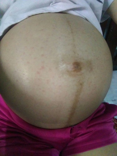 33 weeks