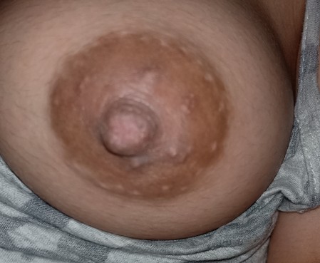 Nipples.