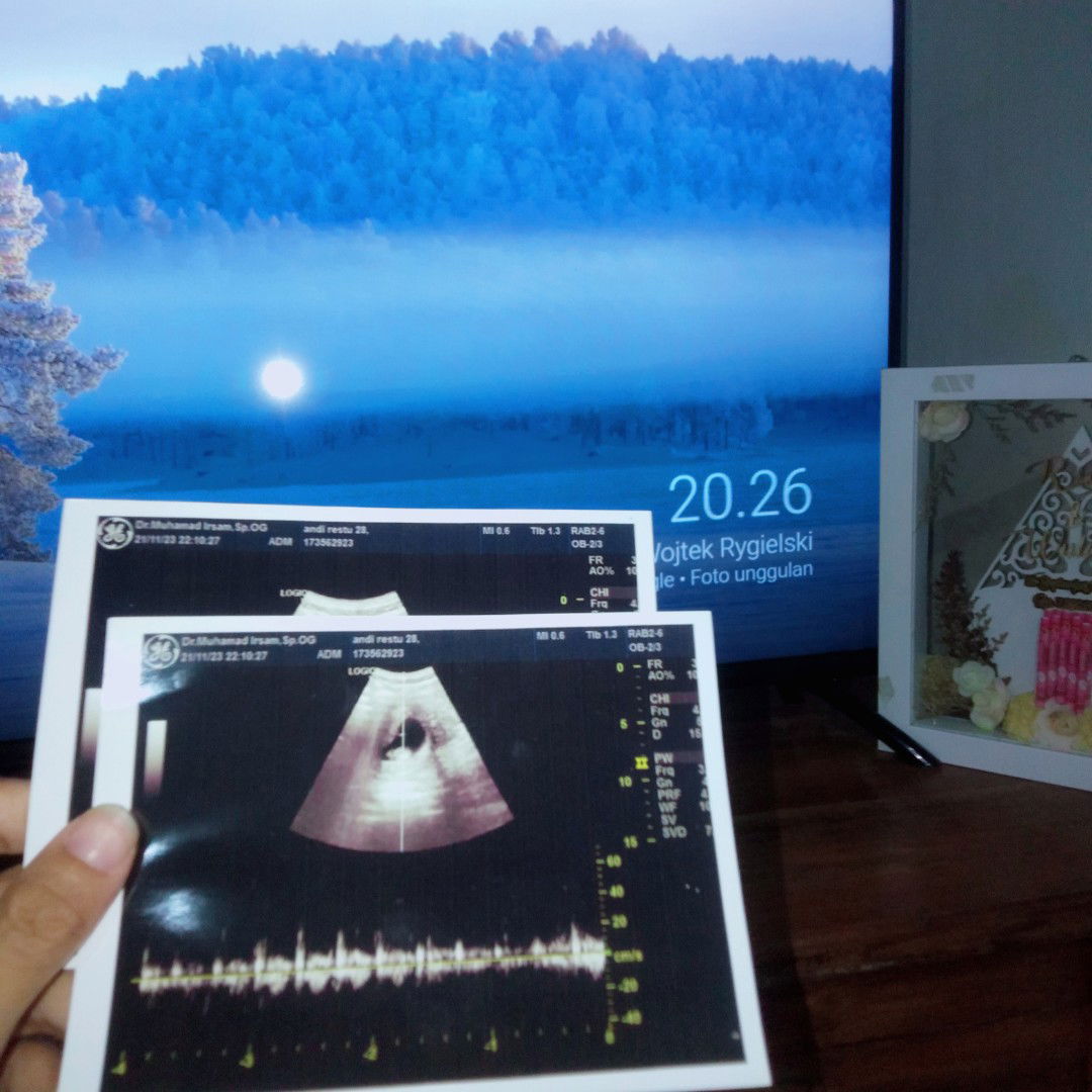 Andi Restu profile icon