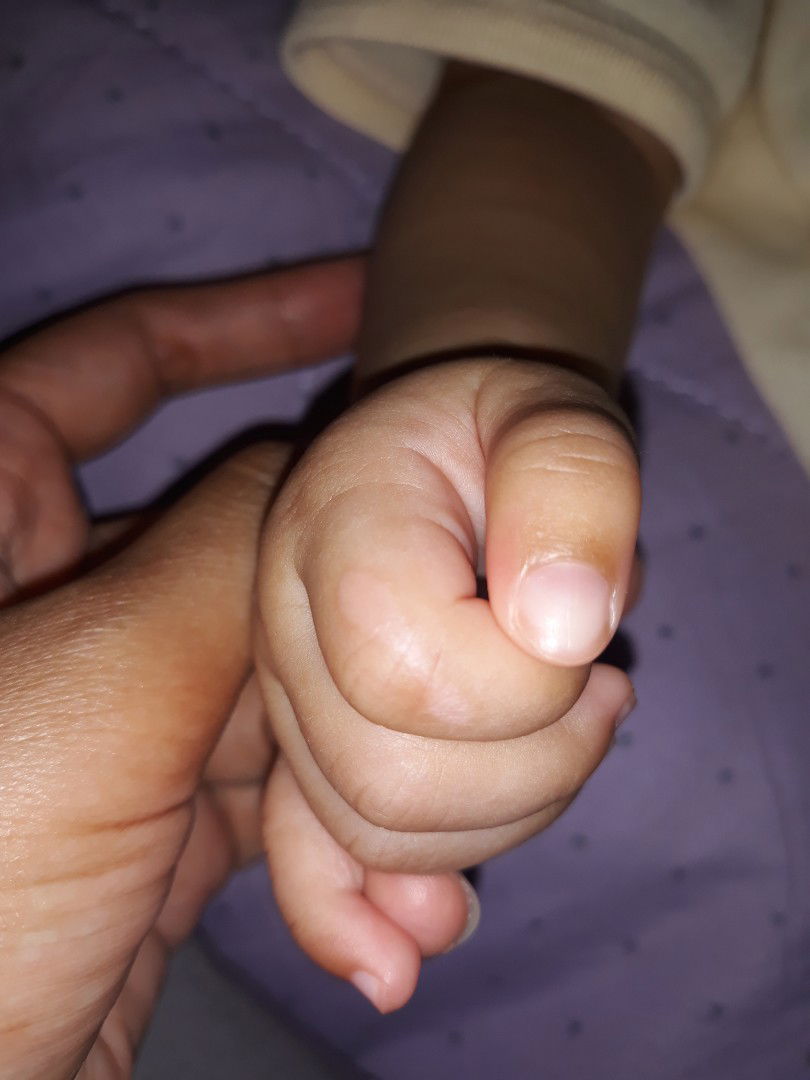 Tanda lahir atau bukan ya bun?