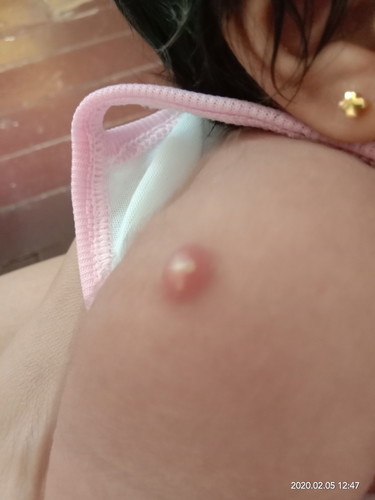 ask ko lng po kung ok lng ung vaccine ng baby ko... ngwworried lng po.... hndi po ba infected?..