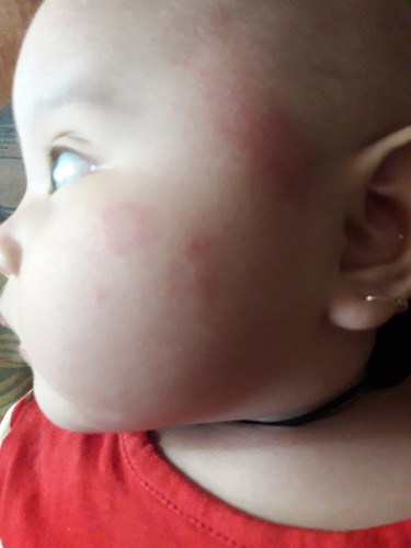 kulit merah