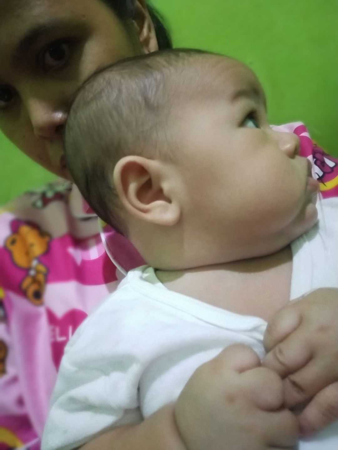 Ruam Merah dileher bayi