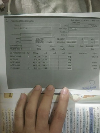 ซาวนด์ตามคลินิคราคาประมาณเท่าไหร่