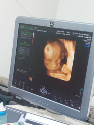 เด็ก22+4w.มารายงานตัวคับ🥰🤟🏻
