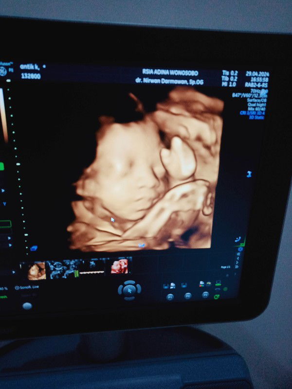 Antik Kurniyati profile icon