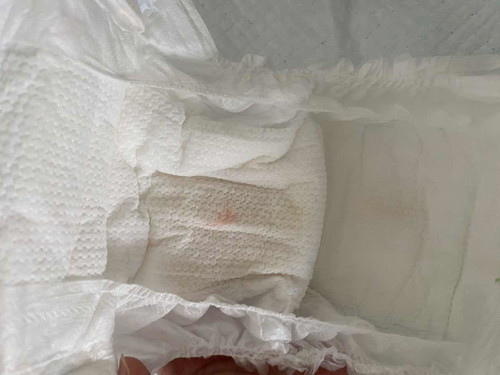 Pink stain in diaper