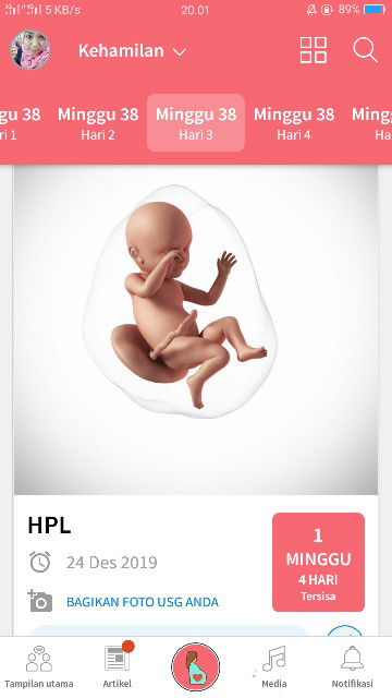 bunda..  ada yg sama dg hpl sayaa..  tp dedeknya sudah lahir...