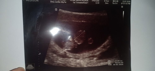 Seneng nya bukan main Alhamdulillah?